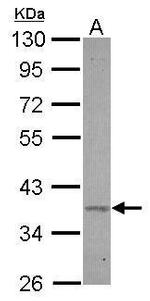 BXDC2 Polyclonal Antibody