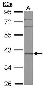 BXDC2 Polyclonal Antibody