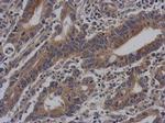 Vezatin Polyclonal Antibody