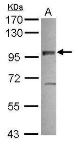 Vezatin Antibody in Western Blot (WB)