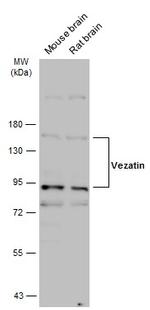 Vezatin Antibody in Western Blot (WB)