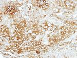 Vezatin Polyclonal Antibody