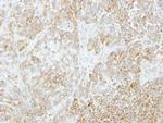 VPS35 Polyclonal Antibody