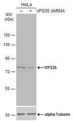 VPS35 Antibody in Western Blot (WB)