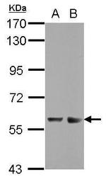 ZNF434 Antibody in Western Blot (WB)