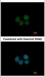 SOHLH2 Polyclonal Antibody