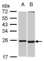 SOHLH2 Antibody in Western Blot (WB)