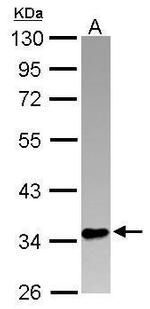 PINX1 Polyclonal Antibody