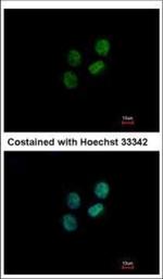 ZWILCH Antibody in Immunocytochemistry (ICC/IF)