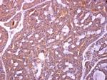 ZWILCH Antibody in Immunohistochemistry (Paraffin) (IHC (P))