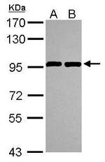 ANKZF1 Polyclonal Antibody