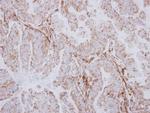 AspRS Polyclonal Antibody