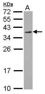 RPRD1A Antibody in Western Blot (WB)