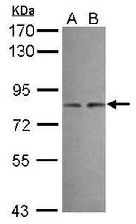 DIP13B Polyclonal Antibody