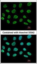 DIP13B Polyclonal Antibody