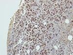 DIP13B Antibody in Immunohistochemistry (Paraffin) (IHC (P))