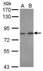DIP13B Antibody in Western Blot (WB)