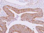 ATAD3A Polyclonal Antibody