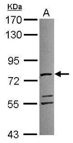 ATAD3A Antibody in Western Blot (WB)