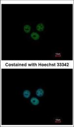 RCBTB1 Polyclonal Antibody