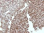 RCBTB1 Antibody in Immunohistochemistry (Paraffin) (IHC (P))