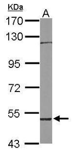 RCBTB1 Antibody in Western Blot (WB)