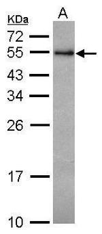 RCBTB1 Antibody in Western Blot (WB)