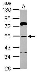 TRIM62 Antibody in Western Blot (WB)