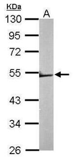TRIM62 Antibody in Western Blot (WB)