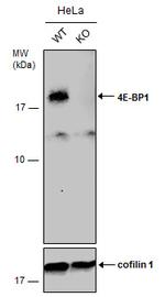 4EBP1 Antibody in Western Blot (WB)