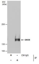 SIN3B Antibody in Immunoprecipitation (IP)