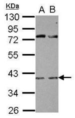 RBFOX2 Polyclonal Antibody