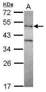 POLM Polyclonal Antibody