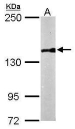 PDS5B Polyclonal Antibody