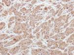 AGAP1 Polyclonal Antibody
