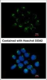 CNDP2 Polyclonal Antibody