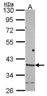 HAPLN2 Polyclonal Antibody