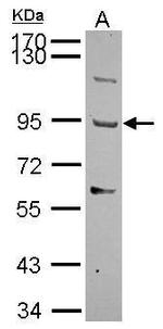 THSD1 Polyclonal Antibody