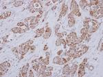 SLC25A23 Antibody in Immunohistochemistry (Paraffin) (IHC (P))