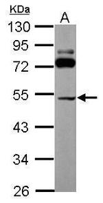 SLC25A23 Antibody in Western Blot (WB)