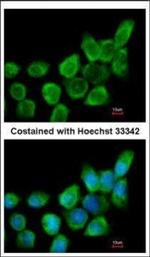 Galectin 1 Antibody in Immunocytochemistry (ICC/IF)