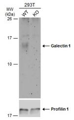 Galectin 1 Antibody in Western Blot (WB)