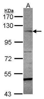 JMJD2A Antibody in Western Blot (WB)