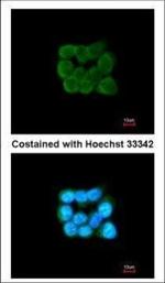 TOMM34 Polyclonal Antibody