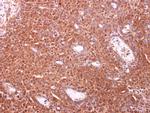 TOMM34 Antibody in Immunohistochemistry (Paraffin) (IHC (P))