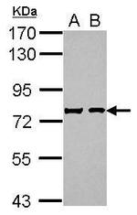 Chromogranin C Antibody in Western Blot (WB)