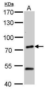 Chromogranin C Antibody in Western Blot (WB)