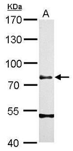 Chromogranin C Antibody in Western Blot (WB)