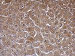 SGCE Polyclonal Antibody