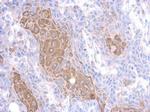 MMP23 Polyclonal Antibody